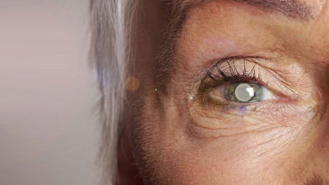 Elderly Women With Cataracts (But Not Men) Have Higher Mortality Rate