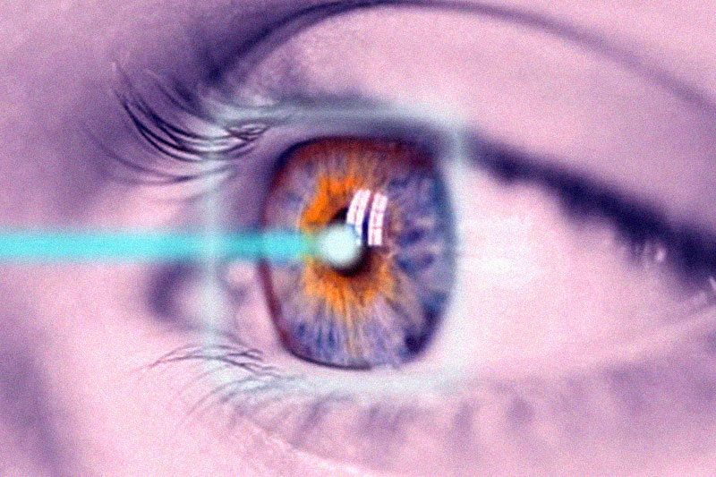 Is LASIK Eye Surgery right for you?