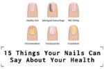 15 Things Your Nails Can Say About Your Health