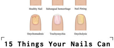 15 Things Your Nails Can Say About Your Health