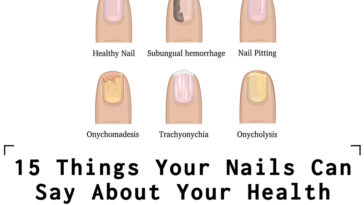 15 Things Your Nails Can Say About Your Health