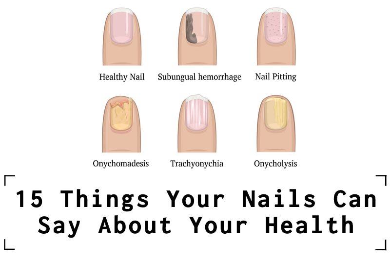 15 Things Your Nails Can Say About Your Health