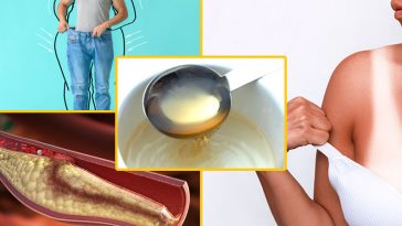 9 Wonderful Health Benefits of White Vinegar That Put Apple Cider Vinegar to Shame