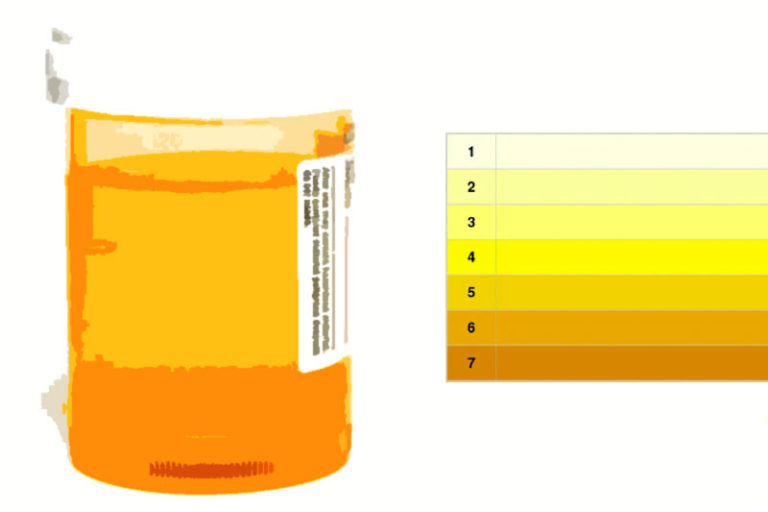 7 Signs With Which The Body Tells You That Something Is Wrong Factspedia