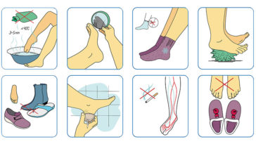 Avoid Complications With These 10 Smart Tips for Diabetes Foot Care