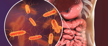 Intestinal gases smell unpleasant due to bacteria
