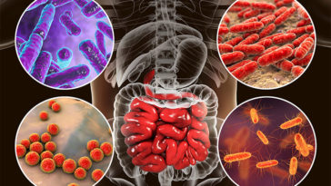 The War Inside Your Gut! Top 9 Enemies Of Your Digestive System