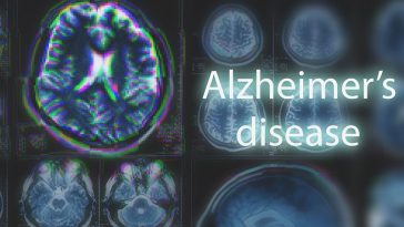 Can Alzheimer's Be Stopped? 9 Lifestyle Changes Can Help Prevent Alzheimer’s Disease