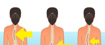 Avoid These 10 Common Activities That May Damage Your Spine