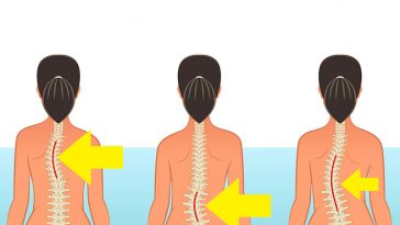 Avoid These 10 Common Activities That May Damage Your Spine