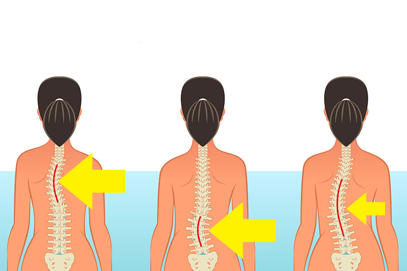 Avoid These 10 Common Activities That May Damage Your Spine