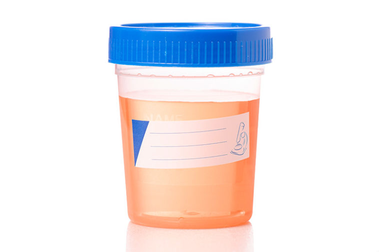 What the Color of Your Urine Reveals About Your Health Factspedia