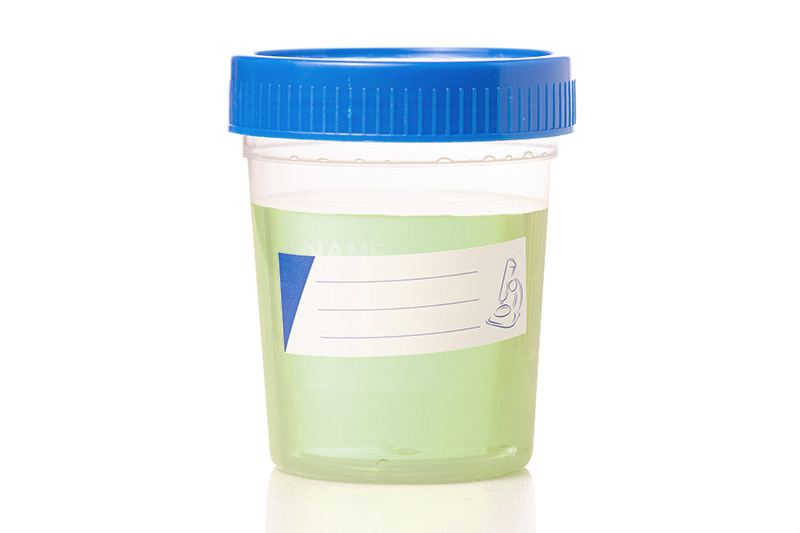 Your Urine is Blue or Green
