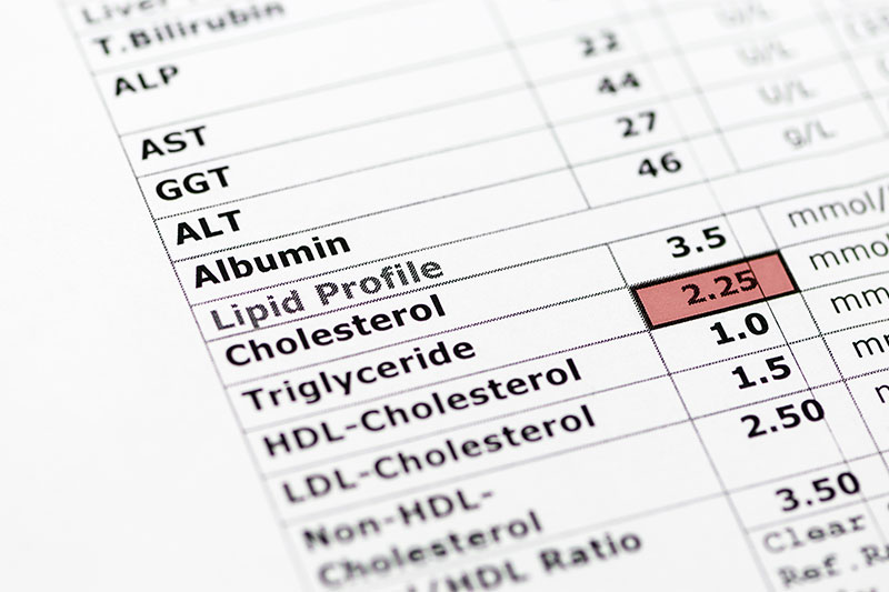 High Triglyceride Levels