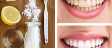 8 Natural Ways to Make Your Teeth Whiter at Home
