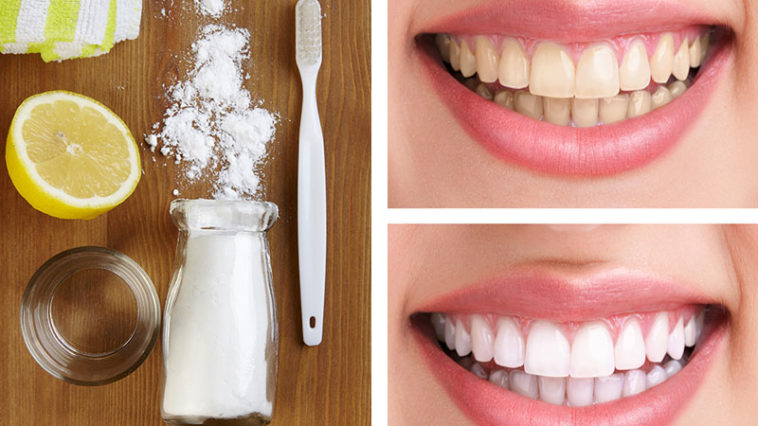 8 Natural Ways to Make Your Teeth Whiter at Home