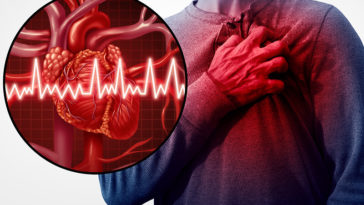 11 Signs You Are About to Have a Heart Attack