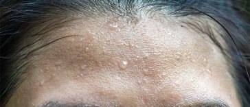 If it’s accompanied by sweating