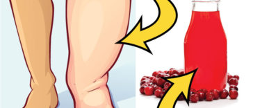 10 Foods and Drinks That Can Get Rid of Water Retention