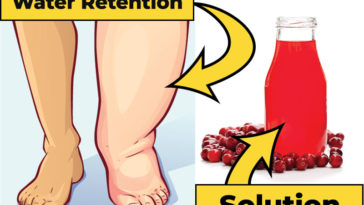 10 Foods and Drinks That Can Get Rid of Water Retention