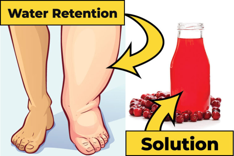10 Foods and Drinks That Can Get Rid of Water Retention Factspedia