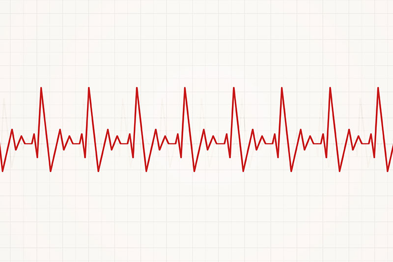 Fast Heart Rate