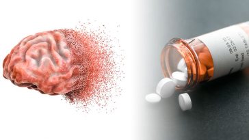 Caution! These 12 Drugs Can Cause Memory Loss