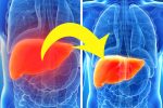 10 Naturally Gentle ways to Remove Toxins from Your Liver, Bladder, and Kidneys