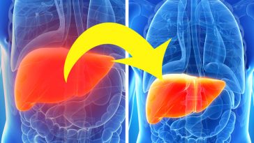 10 Naturally Gentle ways to Remove Toxins from Your Liver, Bladder, and Kidneys