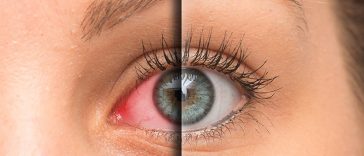 9 Exercises All People With Tired Eyes Need to Do