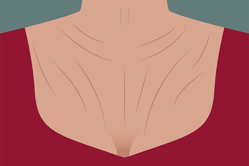 Do Not Ignore The Neck And Chest