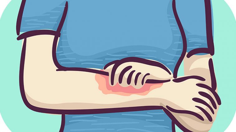 9 Signs Your Mystery Rash Is Something Serious