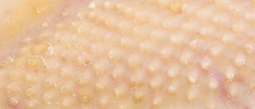 Chicken Skin
