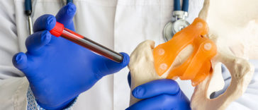 6 Foods That Can Hurt Your Bone Health, According To Experts