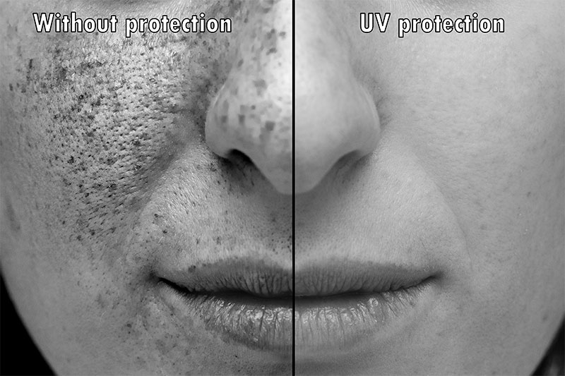 Protect Your Skin From UV Rays
