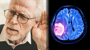 8 Silent Signs You Could Have a Brain Tumor