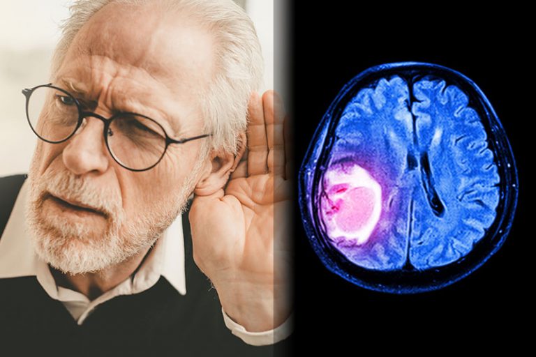 8 Silent Signs You Could Have a Brain Tumor Factspedia