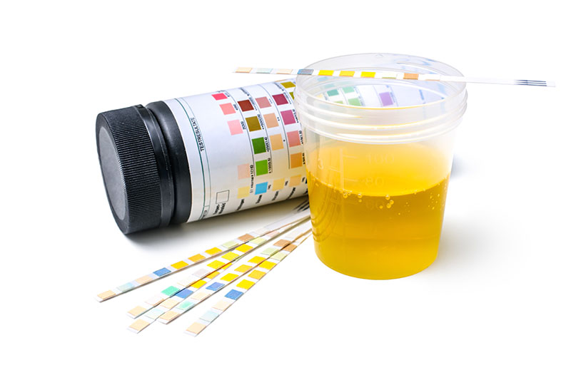 Urinalysis test