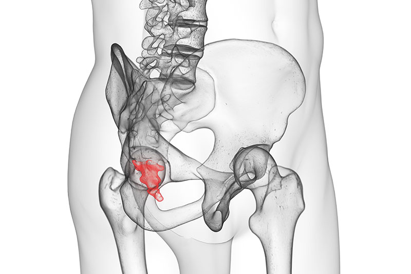 Coccyx, more commonly known as the tailbone