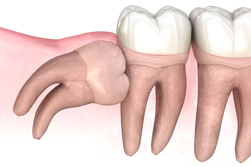 You Have Pressure On Your Teeth