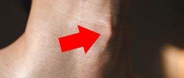 The Real Reason Men Have An Adam's Apple