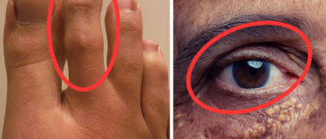 8 Signs That Your Body Is Crying Out For Help