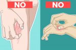 10 Times You Should Never, Ever Scratch an Itch