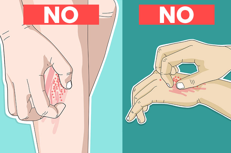 10 Times You Should Never, Ever Scratch an Itch