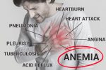 My Chest Hurts. Could I Be Anemic? (8 Silent Symptoms of Anemia)