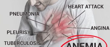 My Chest Hurts. Could I Be Anemic? (8 Silent Symptoms of Anemia)