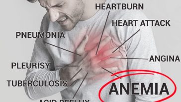 My Chest Hurts. Could I Be Anemic? (8 Silent Symptoms of Anemia)