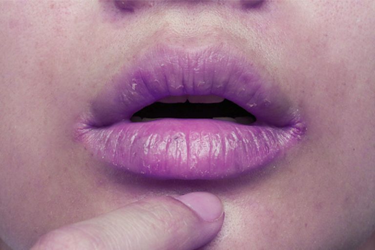 Pay Attention to These 7 Warning Signs That COVID19 Is in Your Lungs