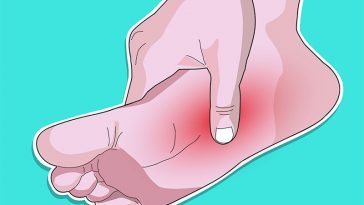 The Surprising Reasons Your Feet Hurt All The Time and How To Get Quick Relief