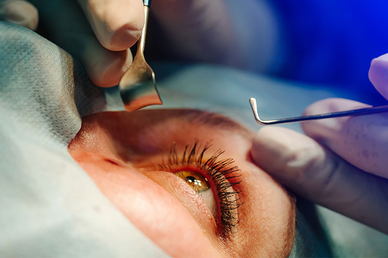 These Foods Will Help You Heal Faster After An Eye Surgery